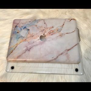 Marble MacBook Pro 15 2017 Case